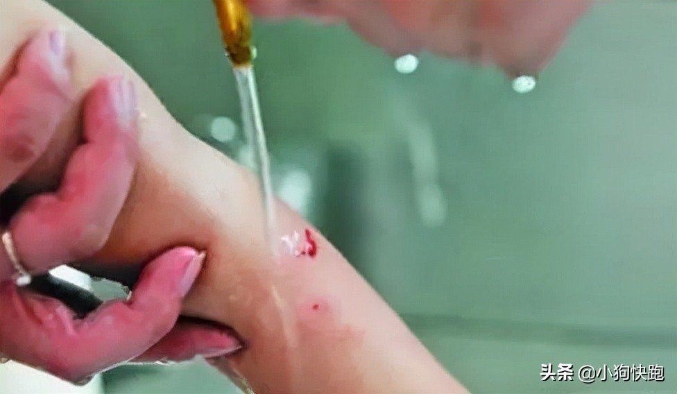 被狗狗咬了怎么安慰,被狗狗咬了要注意哪些事项