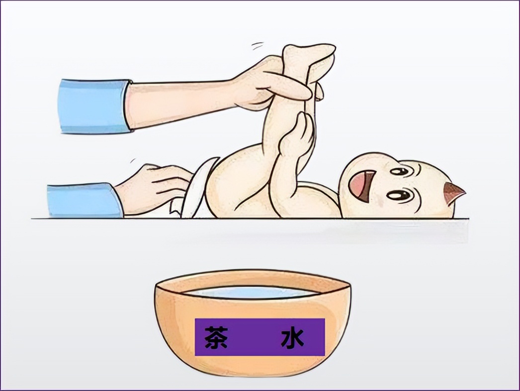 新生儿红屁股快速有效的方法,简单4个步骤帮你搞定宝宝红屁股