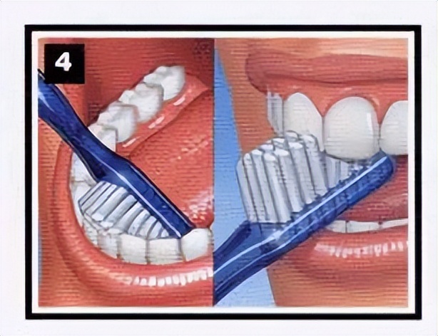 我们的目标是没有蛀牙出处,有没有保护牙齿不蛀牙的办法