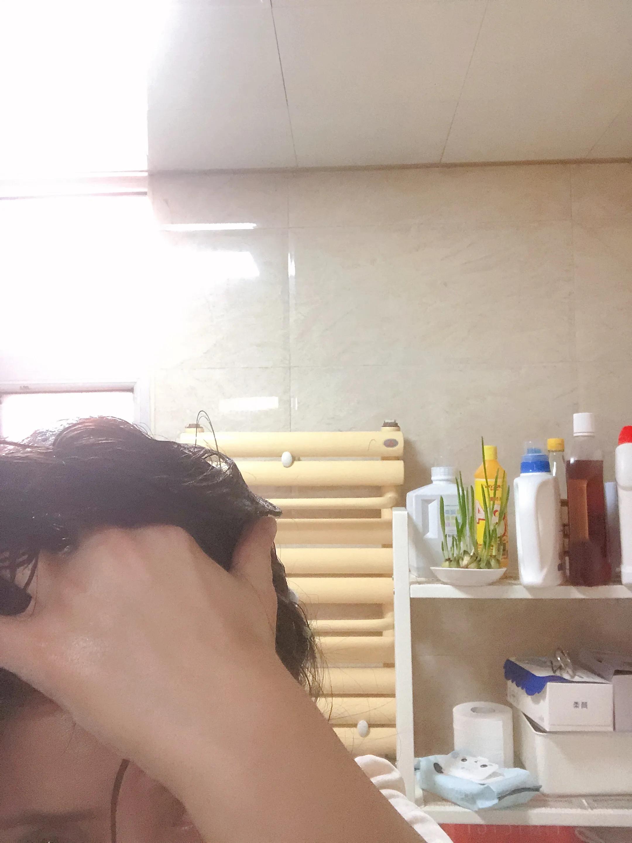 十年头皮屑终结之路