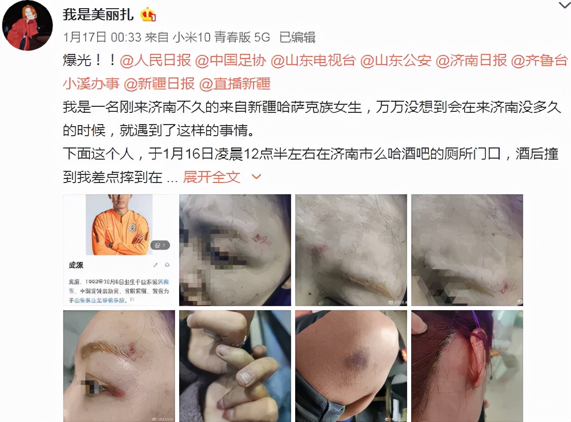山东鲁能成源打人处置是否合理,遭成源殴打女子发声