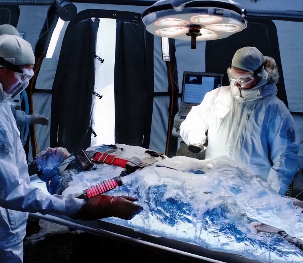 我国首例冷冻人杜虹,中国第一冷冻人杜虹