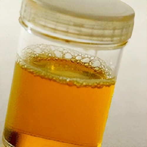 关于蛋白尿的科普文章,蛋白尿揭秘三个原因让你恍然大悟