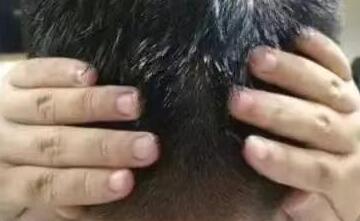 鏄ュぉ閲屼綋寮卞鐥呯殑浜轰笉鑳藉悆鍙戠墿,鏄ュ涓轰粈涔堜笉鑳藉悆鍙戠墿