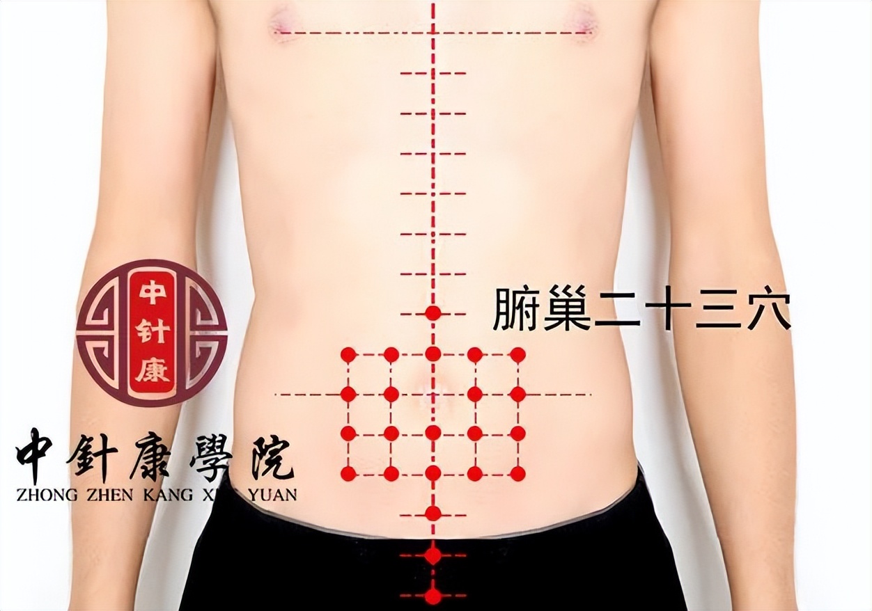 （二）董氏奇穴临床运用体应针法与灸法