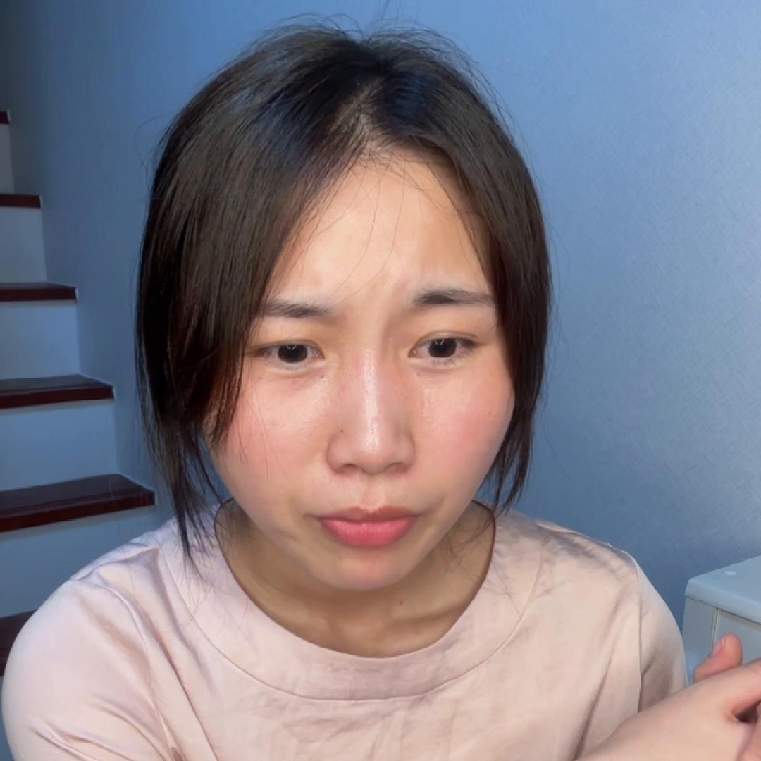 拖着红肿的脸和姐妹们深夜夜聊｜🇰🇷医美真的很值吗？