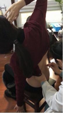 腰椎侧弯腰痛吃什么药,臀肌筋膜炎导致腰椎侧弯