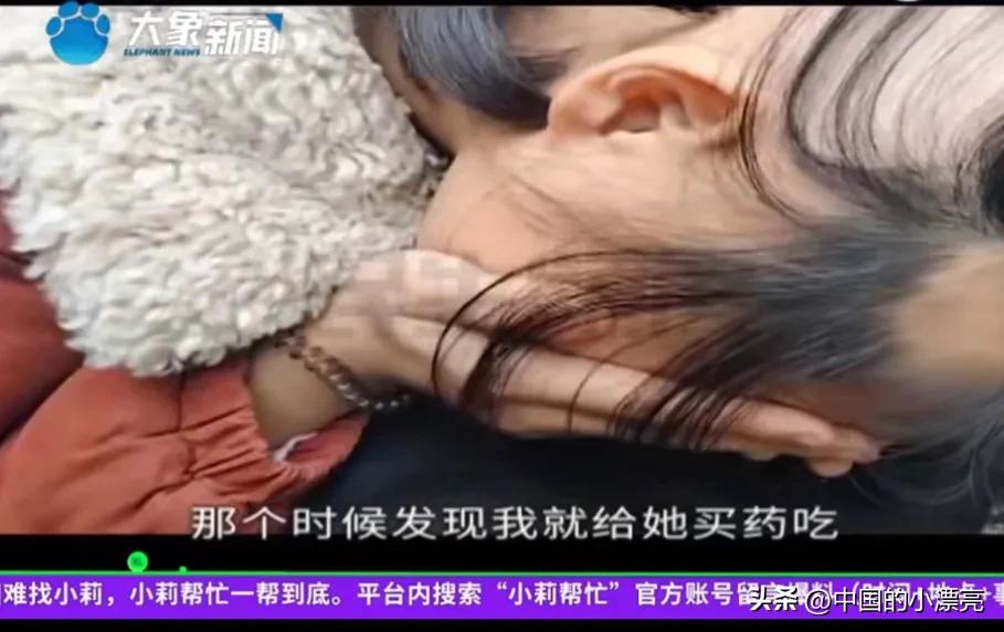 13岁女孩拔自己的头发,拔发癖的女孩