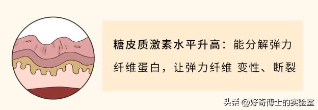 大腿上有白色条纹怎么回事,女生大腿外侧有红条纹是什么原因