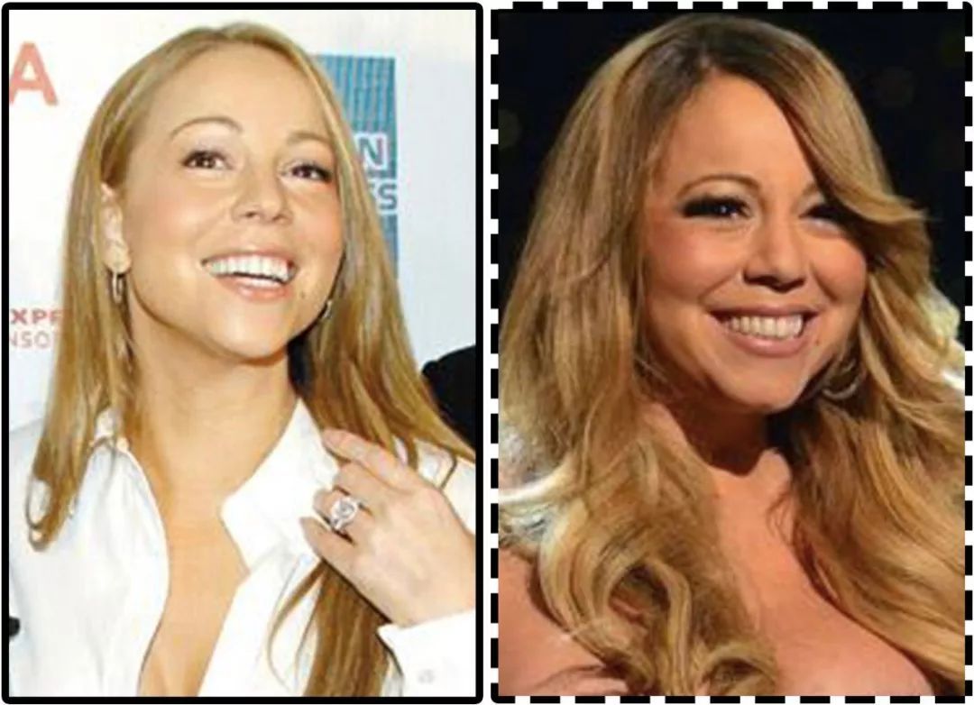 法令纹泪沟脸颊干瘪怎么化妆,下垂法令纹护肤产品