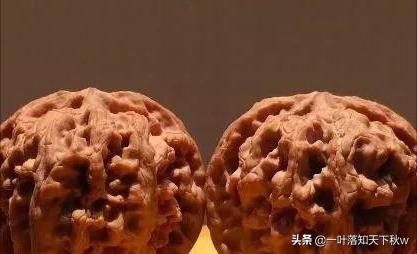 脸盲症犯了,脸盲症又犯了怎么回事