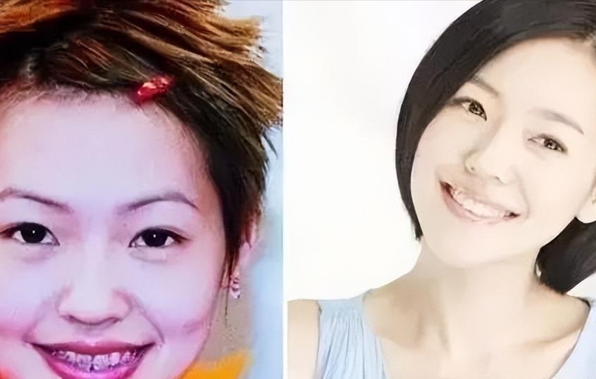 明星的牙都很齐吗,明星的牙齿都很好看