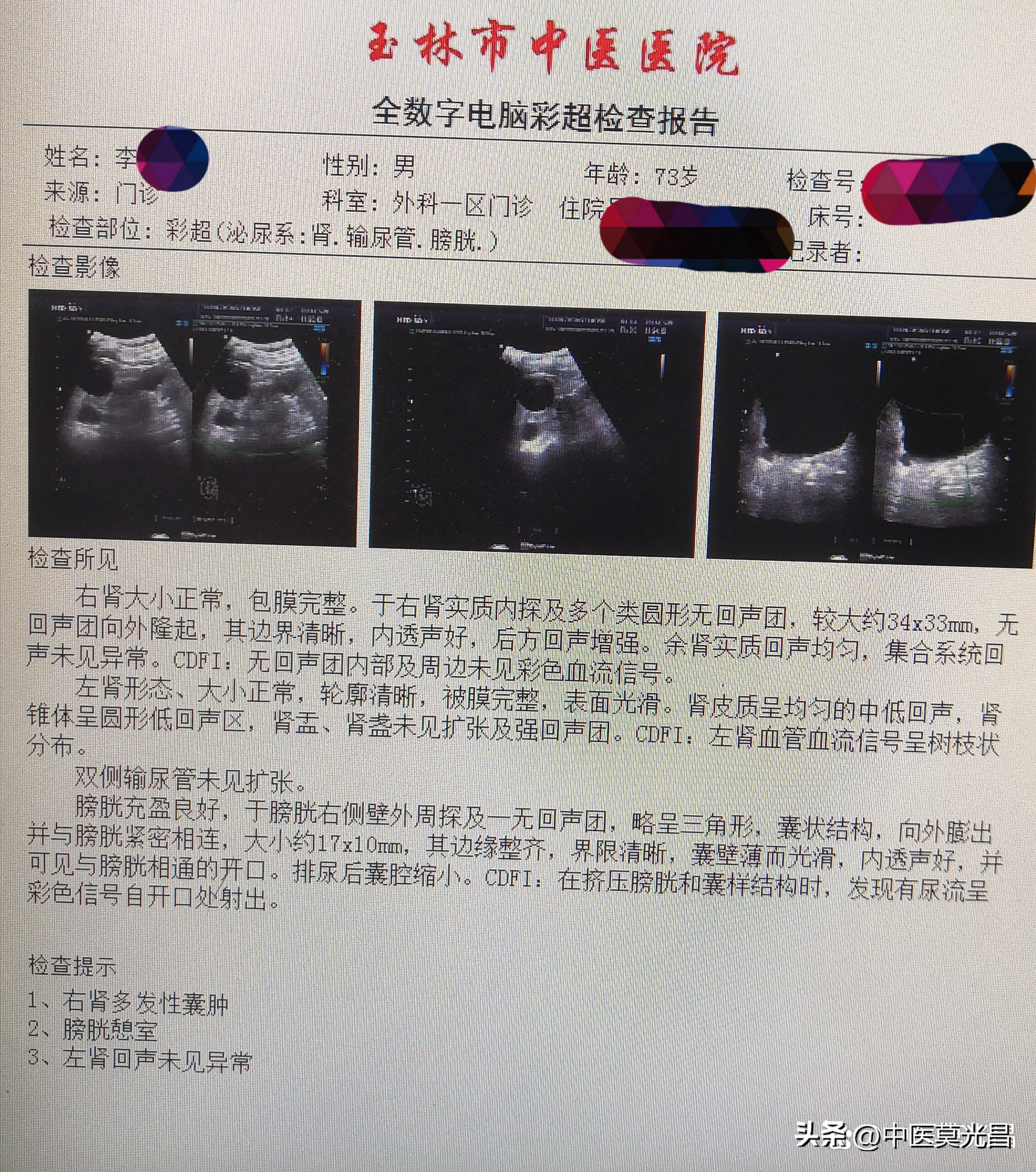 前列腺增生对膀胱结石有影响吗,前列腺增生膀胱炎食疗