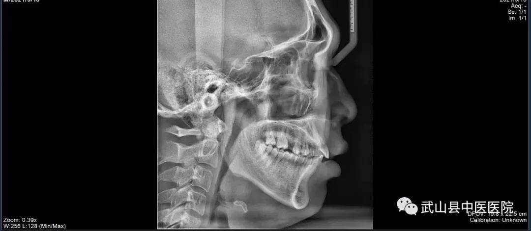 口腔科CBCT,口腔科cbct设备怎么选择