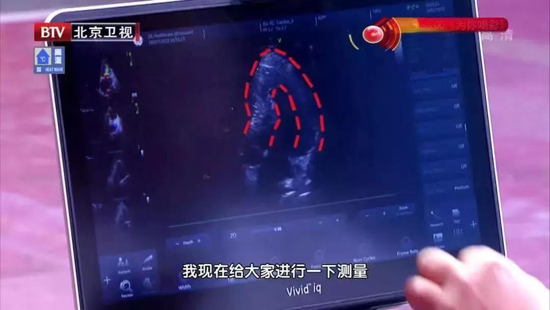 2年没复查结节竟然变成了癌症,息肉化验是癌前病变怎么办