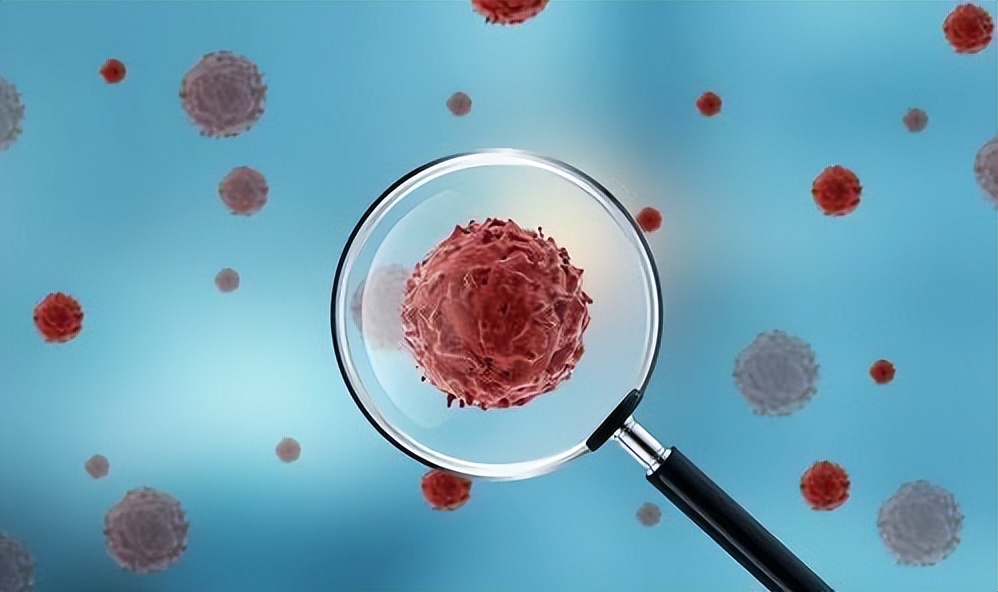 从炎症到癌症多长时间,炎症发展成癌症需要多久