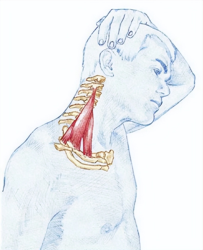 颈复康治疗颈源性头痛吗,颈源性头痛整体解决方案