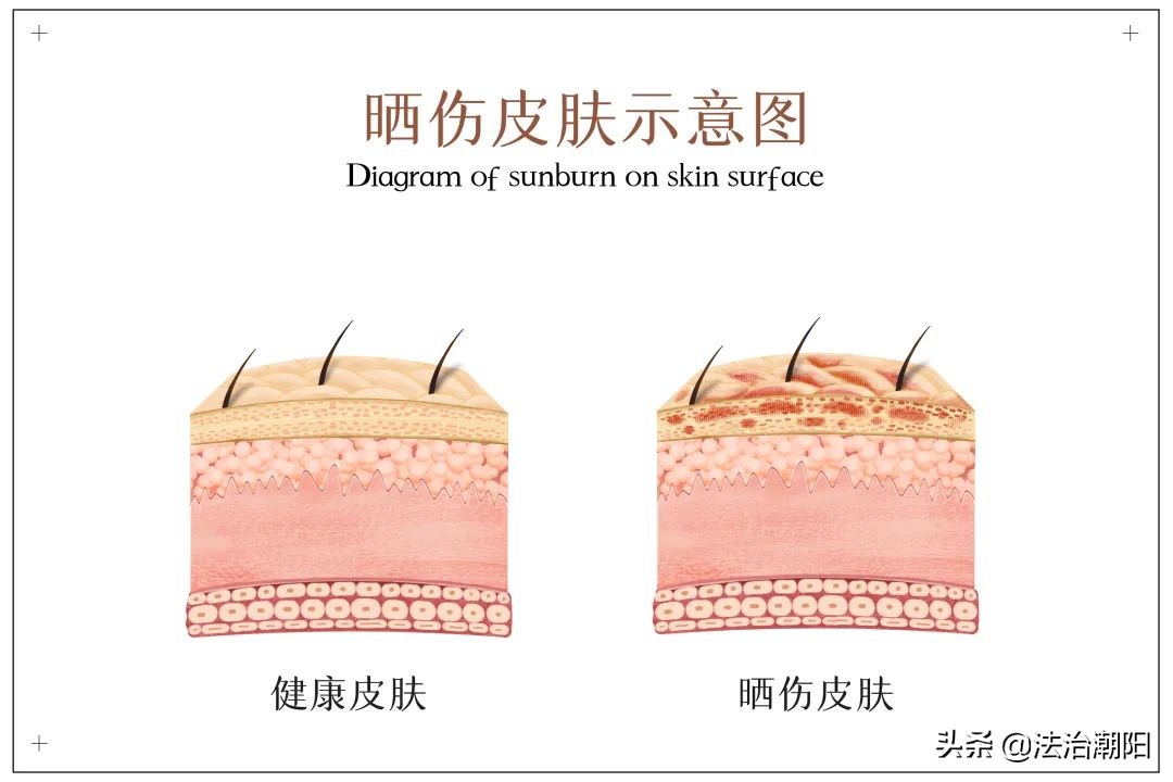 阴天身体防晒怎么用才正确,阴天用防晒霜的防晒指数