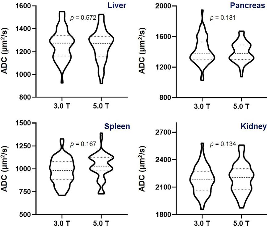 联影上市视频,联影上市晚会