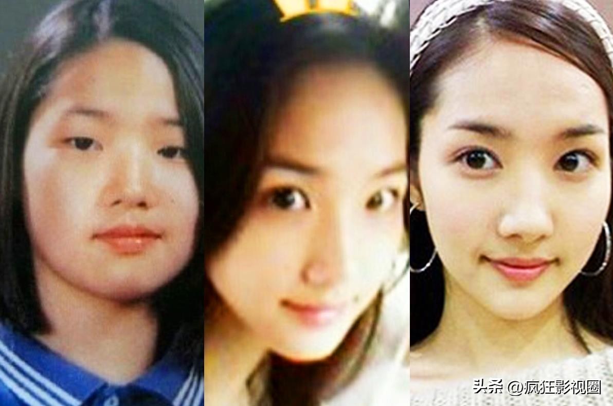 韩国女星朴敏英整容,朴敏英被称为韩国整容界女星范本