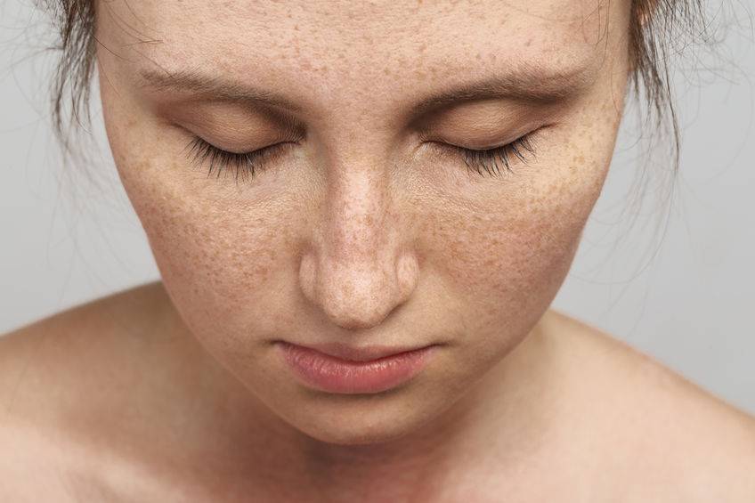 脸上长斑的原因以及解决方案,脸上长斑的原因和治疗方法