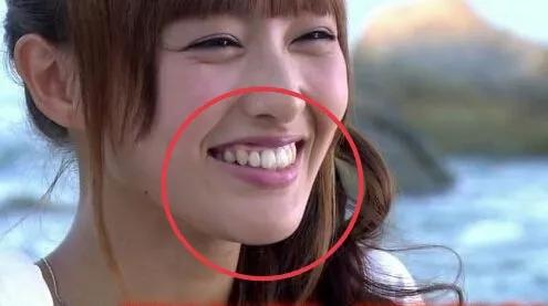 明明是绝顶大美女，却被牙齿拉胯，这15位女星苦不堪言