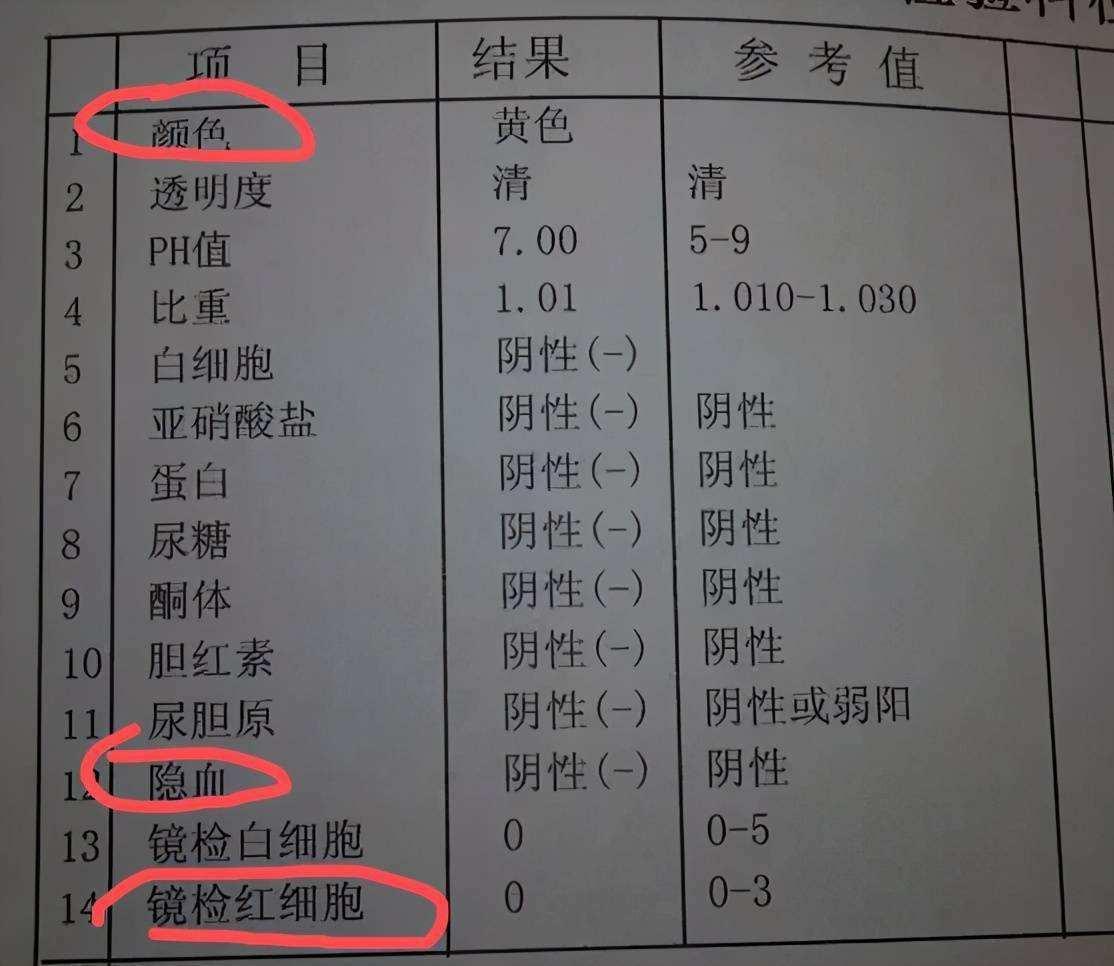 尿潜血试验阳性尿白细胞阳性,尿潜血试验阳性吃什么药治疗