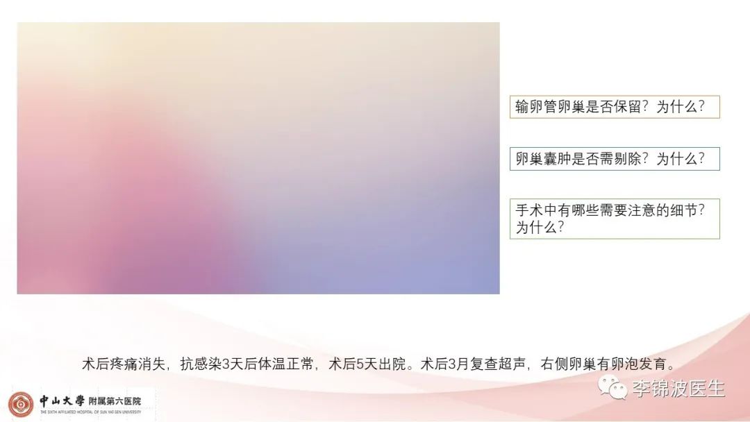 附件扭转手术治疗不良影响,附件扭转是保守治疗还是手术