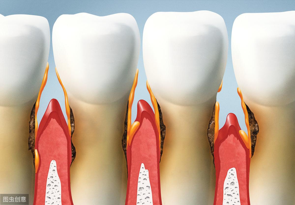 年纪大了牙齿变短是什么原因,年纪大了牙齿变长