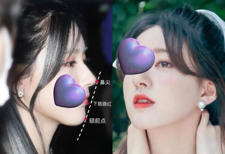 国民初恋毁容了,国民初恋盛世美颜