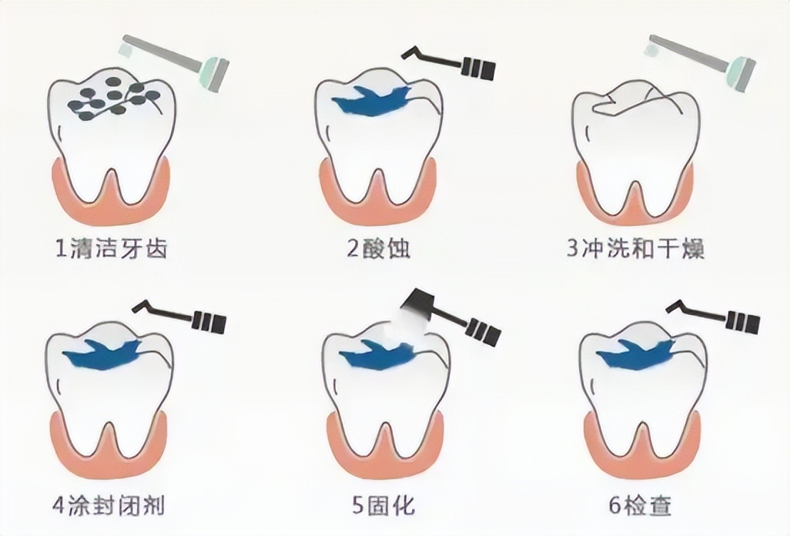儿童电动牙刷扉乐飞利浦测评,欧乐b和飞利浦电动牙刷评测