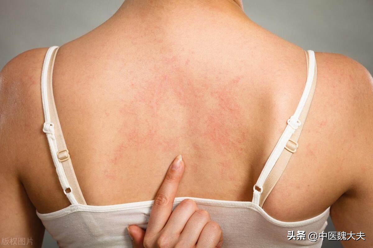 对精子过敏的人,对精子过敏是指对所有精子过敏吗