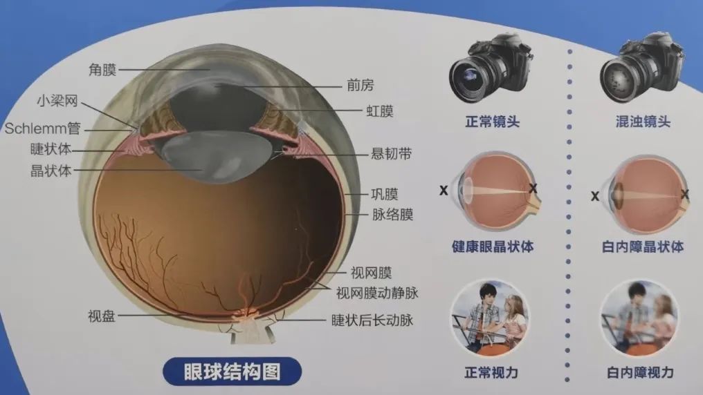 眼干眼涩喝什么茶能缓解,产妇怎么缓解眼干眼涩