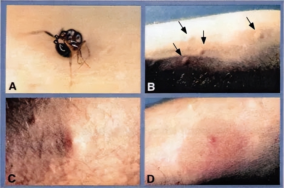 夏日带孩子户外活动当心这种虫,暑期带娃小心毒虫