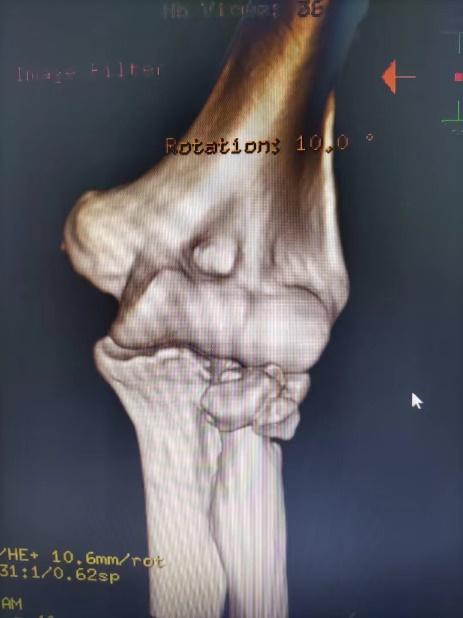 优秀!重庆两江新区中医院年度十佳技术出炉!