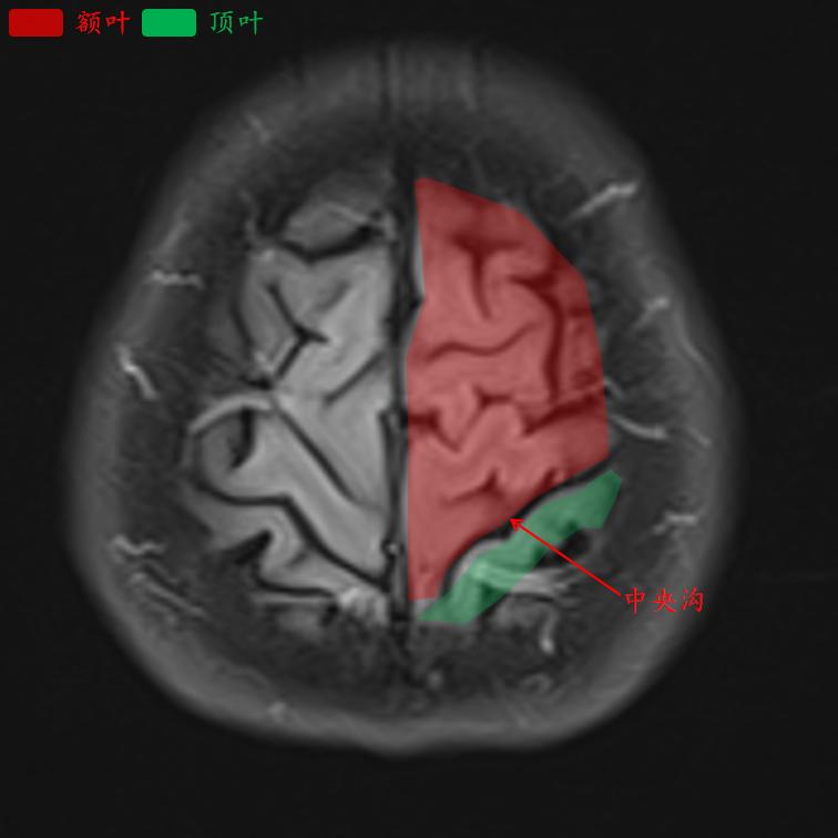 肘关节mri图谱大全,腕关节mri解剖图谱