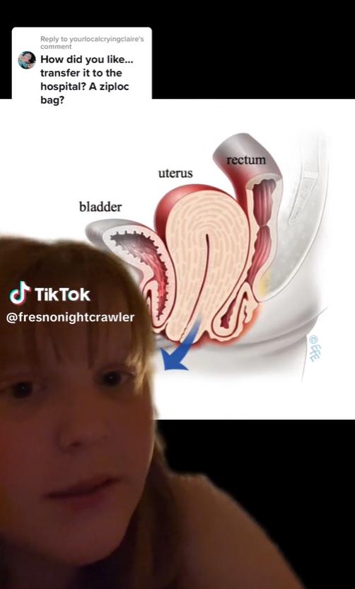 18岁妹子不小心放了个大响屁，没想到居然把自己子宫嘣了出来