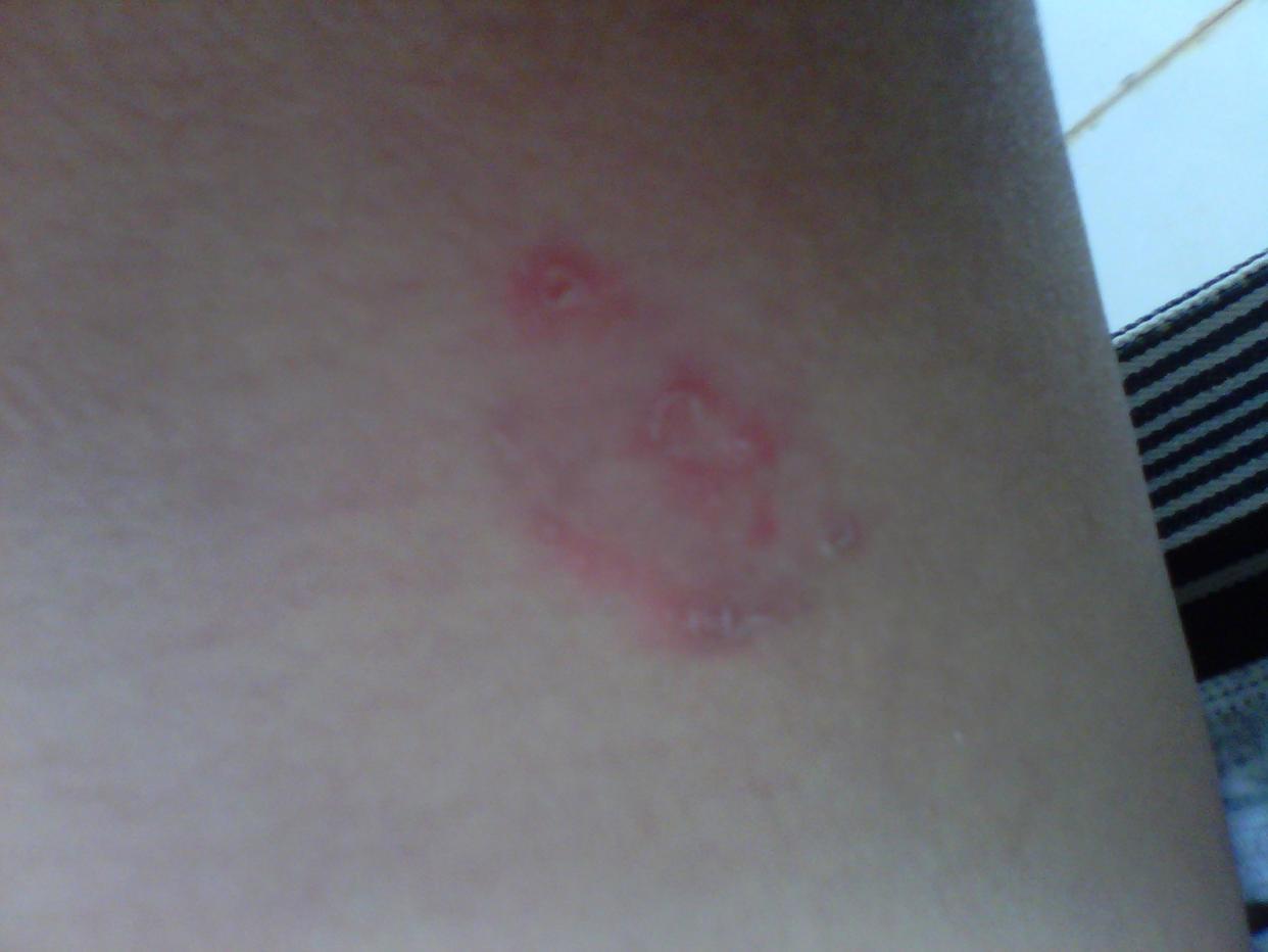 宫颈癌来的时候会出现什么症状,宫颈癌的哪8种症状表现最严重