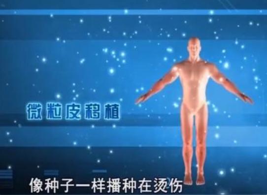 河南男子掉入油锅后来怎么样了,河南男子掉进油锅