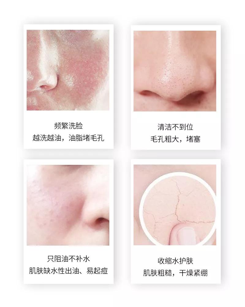 泥膜用多了屏障受损,护肤品推荐泥膜