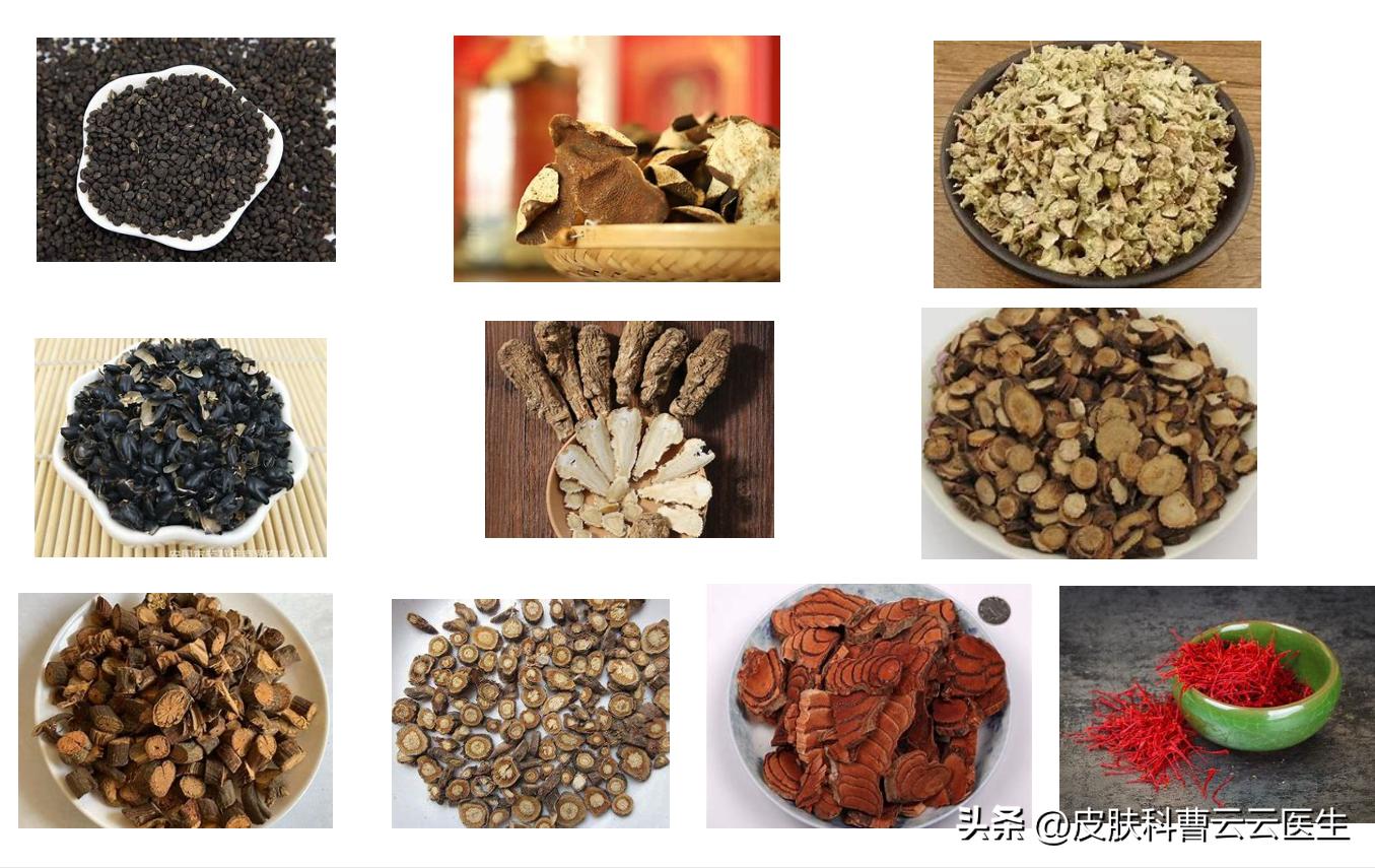 中药治疗银屑病用什么药,张仲景中药治疗银屑病方子