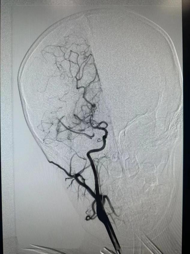 脑卒中多学科协作的好处,多学科联合协作抢救患儿