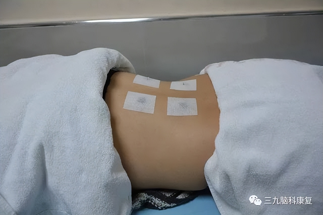 妇幼科普之：卵巢保养好，女性更年轻