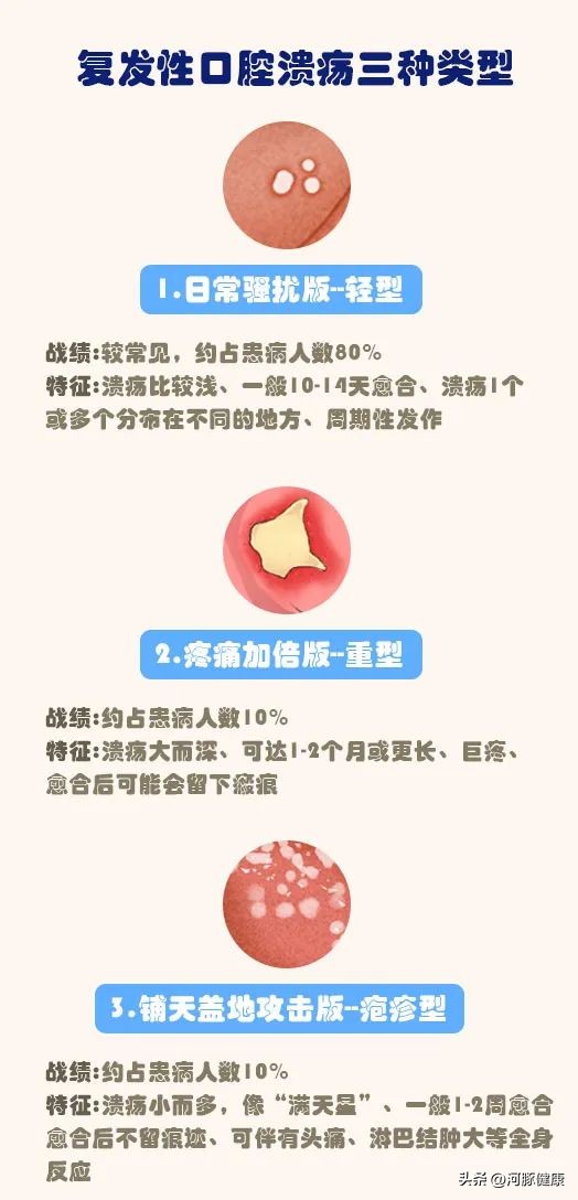 长期口腔溃疡一直不愈是癌吗,口腔溃疡不管它一般几天就能自愈