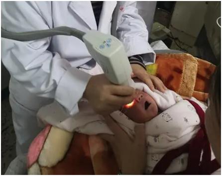 新生婴儿感觉身体软软没有力气,基因检测小胖威利综合症