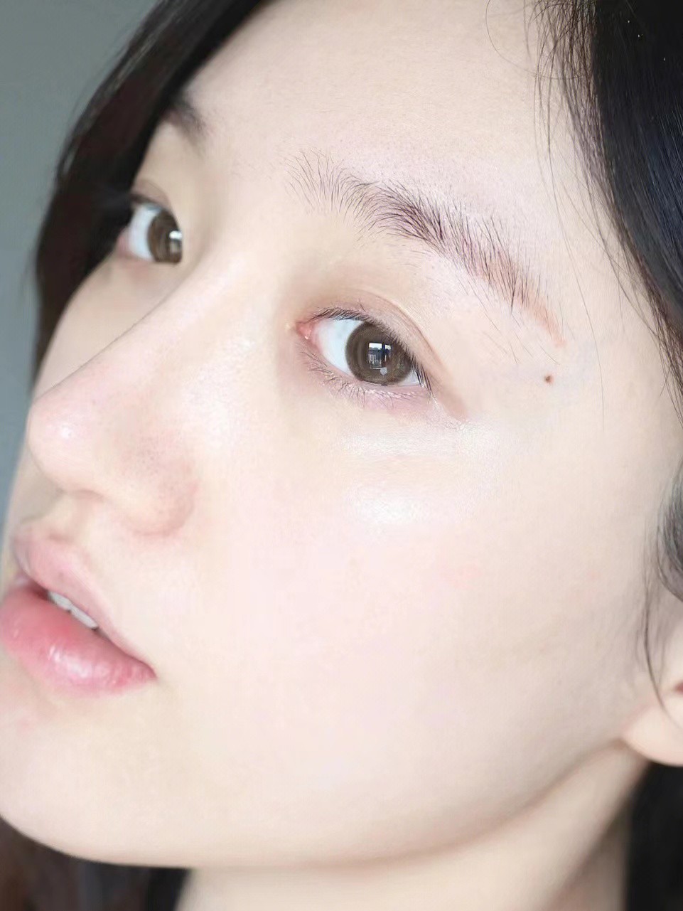 毛孔粗大是什么原因应该怎样改善,毛孔粗大的原因及改善方法