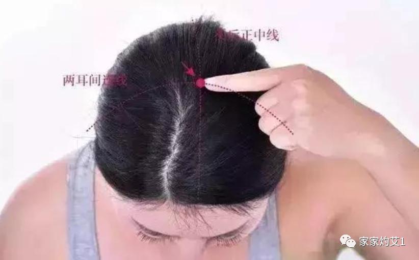 艾灸为何能调百病,艾灸百会穴有血冲顶的感觉