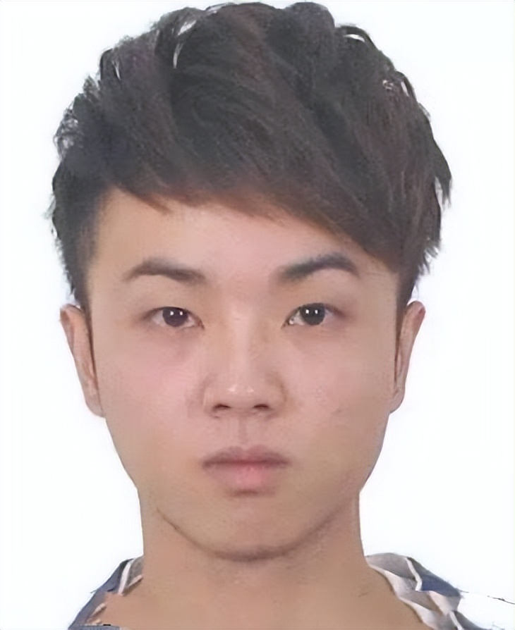 华晨宇削下颌骨的后果,华晨宇下颌骨内推