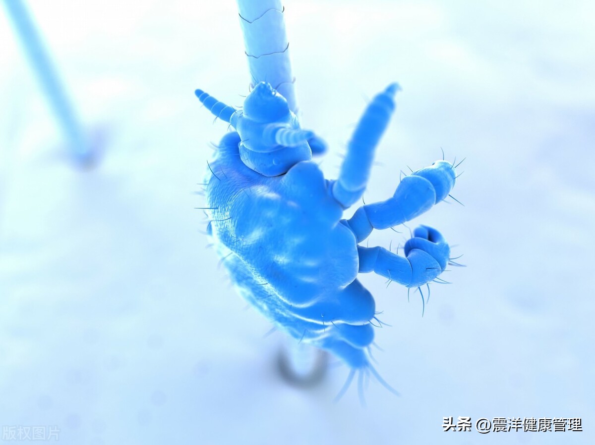 男子腹部痒，医生用镊子夹出16只阴虱！原来阴虱的传播途径有4个