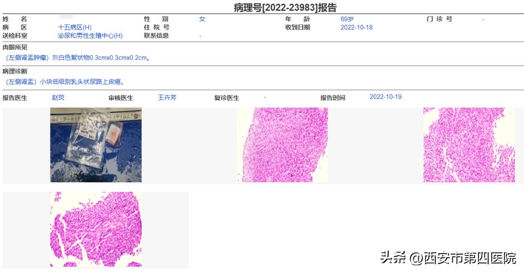 #健康中国行动2030#不明原因尿血7个月，一条热搜治好了她的病